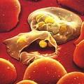 血液中的瘧疾病原蟲現形（照片來源：University of Erlangen）