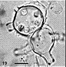 蛙壺菌孢子囊(sporangium)呈現圓形或椭原形