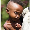 飢餓的衣索比亞小孩。圖片來源：Environmental Health Perspective