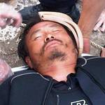 Song, Kang Ho博士遭施工單位與軍方毆打致昏。照片來源：thinkunit