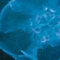 圖1.海月水母的近照（攝影：蘇焉）