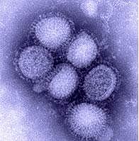 A/H1N1流感病毒。圖片來源：美國疾病管制局