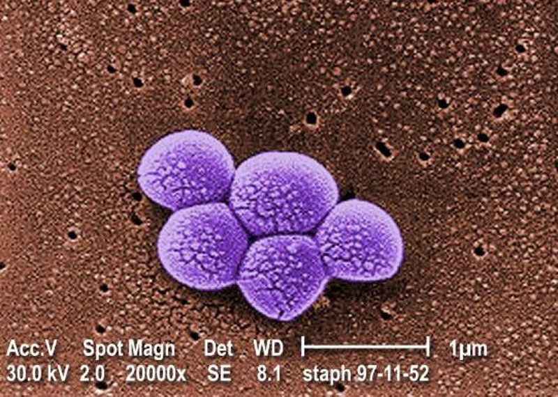 代替抗生素來殺菌 研究：超短脈衝光殺死99.9％以上超級細菌MRSA