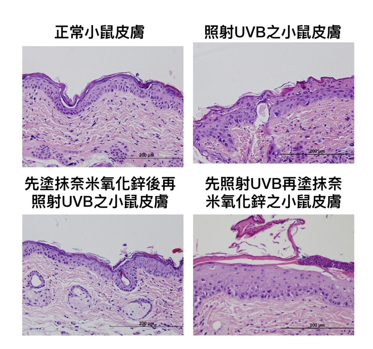奈米氧化鋅是「防曬神隊友」？ 中國醫藥大學研究揭如何挑選安全防曬