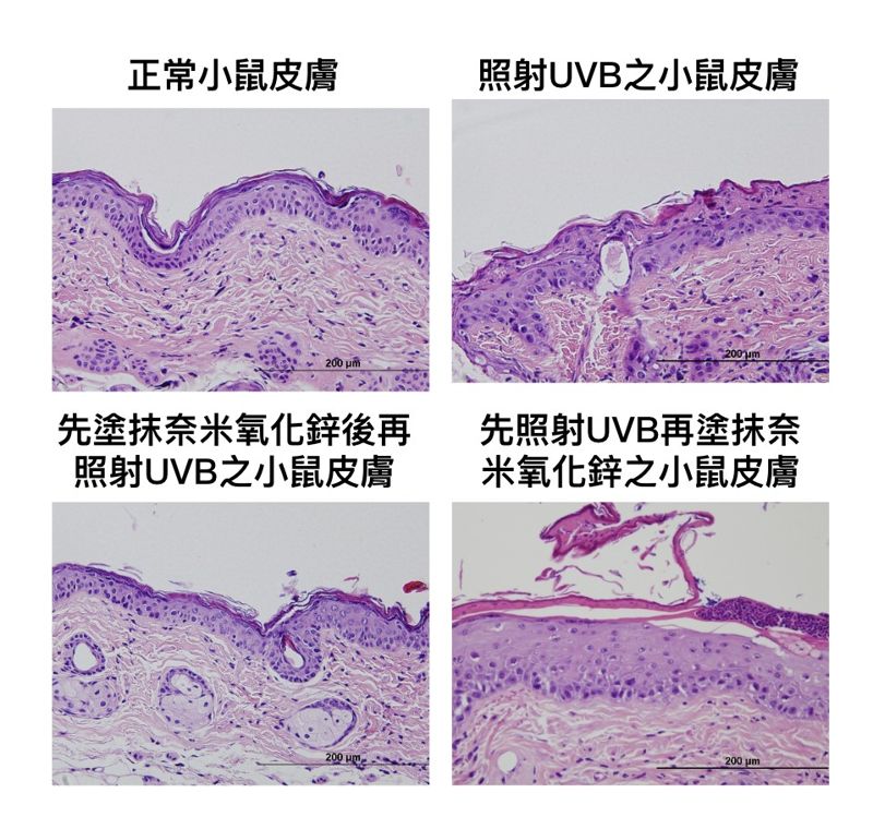 奈米氧化鋅是「防曬神隊友」？ 中國醫藥大學研究揭如何挑選安全防曬