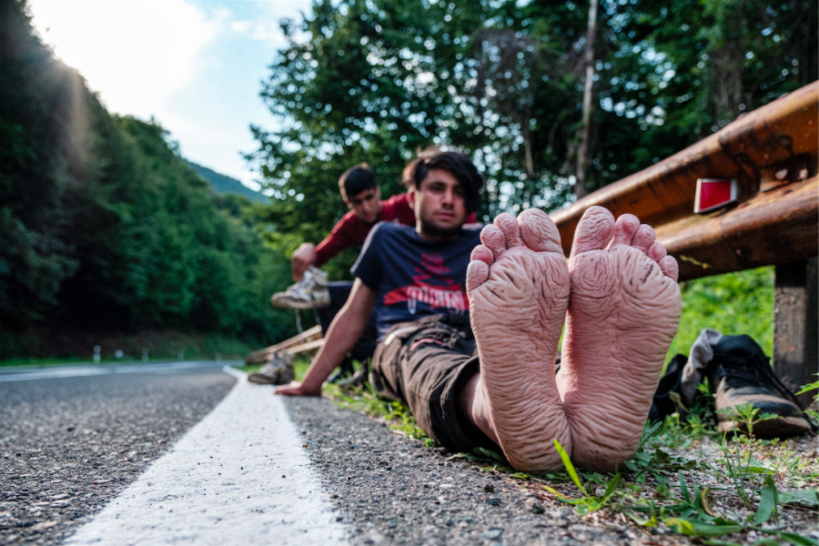 兩名年輕的阿富汗難民坐在靠近克羅埃西亞邊境路旁。移民被強制與一般大眾隔離，但是有越來越多人因此受到感染，這可能會導致毀滅性的後果。移民本就面臨許多健康風險，通常他們只能買到非常便宜的鞋子，在不利的天氣條件下穿過河流和高山，容易受傷卻得不到治療，進而遭感染。這名男子的「壕溝足（Trench foot）」是由於不適當的鞋子和長時間暴露在潮濕環境中造成的。（比哈奇，波士尼亞，赫塞哥維納，2020年6月）攝影：Ziyah Gafic / Pulitzer Center / National Geographic Society / VII