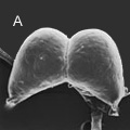 圖3.電子顯微鏡下的昆蟲內分泌器官。A：腦（250倍）；B：咽喉側腺（1000倍）； C：前胸腺（150倍）。此圖為A